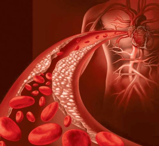 每天壓腿能減輕腳疼 特別是穿高跟鞋的女性！