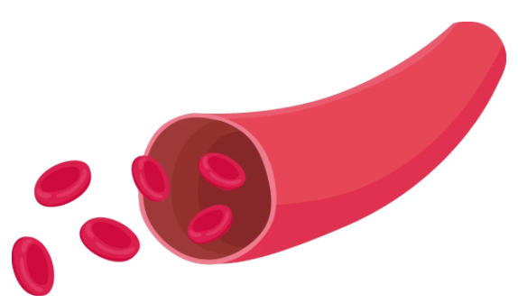 每天壓腿能減輕腳疼 特別是穿高跟鞋的女性！